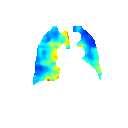 3.4 Beräkning av mätvärden Se artikeln, avsnitt Method for analysis of inhomogeneities. Hur stor omgivning i cm 3 används för att beräkna CV-värdet i och vad motsvarar det i antal voxlar?