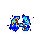 Filtrera nu SPECT-volymen med butterworth-filtret. Resultatet ska se ut som i Fig. 11.