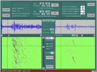 signal, t ex komprimering av tal i GSM-systemet.