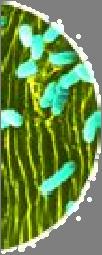 (Bacillus thuringiensis)