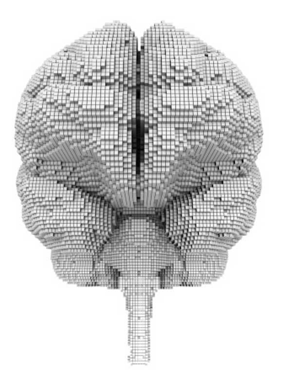 Diusion Tensor Imaging (DTI) En 3D tensor (ellipsoid) kan skattas för den huvudsakliga