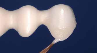 2:a skulderbränning (valfritt) Efter 1:a bränningen kan det hända att skuldran behöver justeras genom slipning. Isolera modellen igen med IPS Ceramic Separating Liquid.