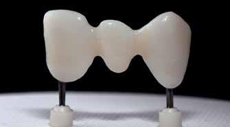 ZirLiner-materialet. Blanda Dentin eller Deep Dentinmaterial med Build-Up vätskor allround eller soft.