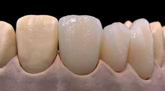 Genomför 2:a Dentin/Incisalbränning på honey-comb brännbrickan som tillhör ugnen och bränn med de angivna