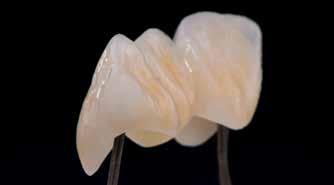 Add-On Margin Add-On Dentin Add-On Incisal Add-On Bleach Variant 1 Add-On med Glaze-bränning Denna variant används om mindre justeringar görs med Glaze-bränning Add-On Margin Blanda