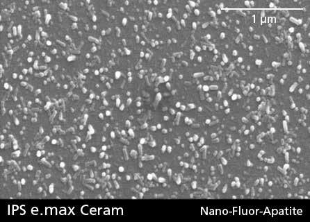 CAD/CAM teknik. Denna glaskeram, som innehåller nano-fluorapatitkristaller uppvisar en kristallstruktur som liknar den naturliga tandens.