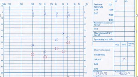 Fall 2 2018 Bilateral anpassning på