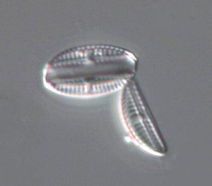 Exempel på sådana arter är Brachysira neoexilis (Figur 10), Navicula heimansioides och Psammothidium abundans (Figur 10).