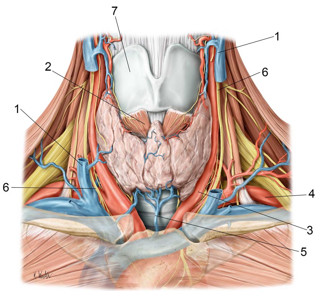 OSOF - Integrerad Tentamen Tema 1-6 2017-08- 15, kl. 09:00-12:00 och 13:00-16:00 Tema 6 Thyroidea Ibland bildar sköldkörteln för mycket hormon.