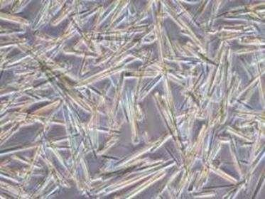 30-50 varav 75-90% poly, ev odling Polarisationsmikroskopi