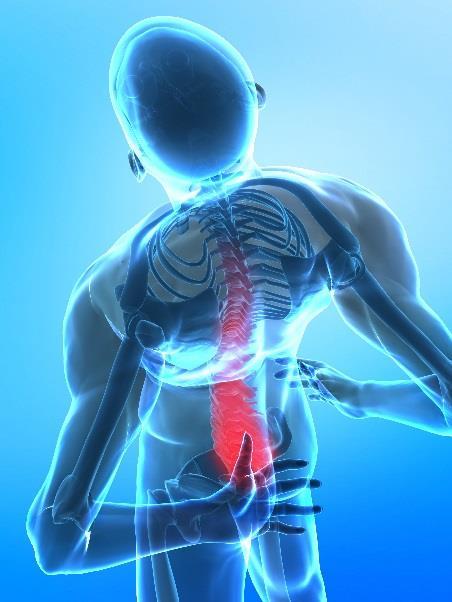 2. Inflammatoriska ryggsjukdomar + PsA Tidig diagnos och behandling är viktig vid spondylartrit (SpA) sjukdomar.