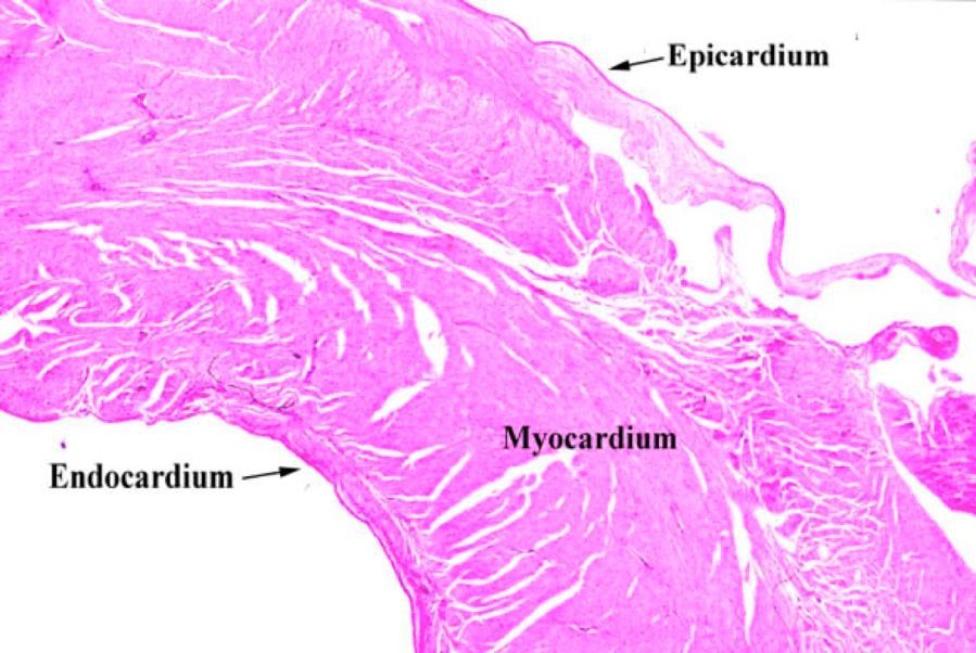 Cor Pericardium (hjärtsäck) Epicardium