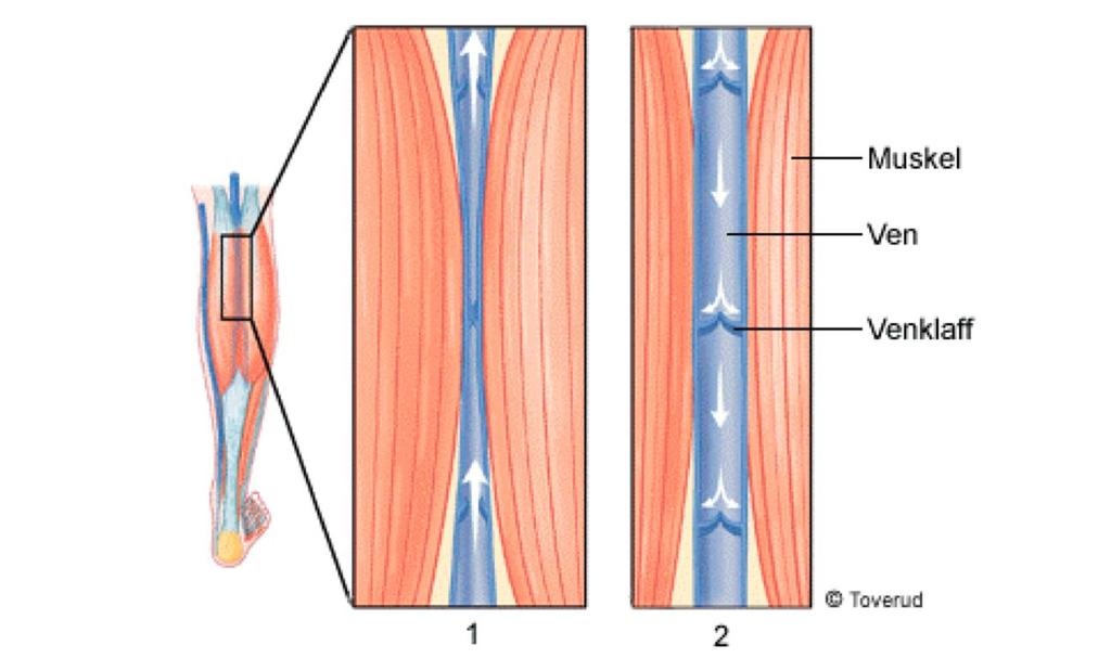 Blodtransport i vener: 1. Muskel-venpumpen 2.