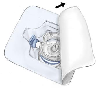 --------------------------------------------------------------------------------------------------------------------------- Instruktioner för beredning och administrering Aseptisk teknik är nödvändig