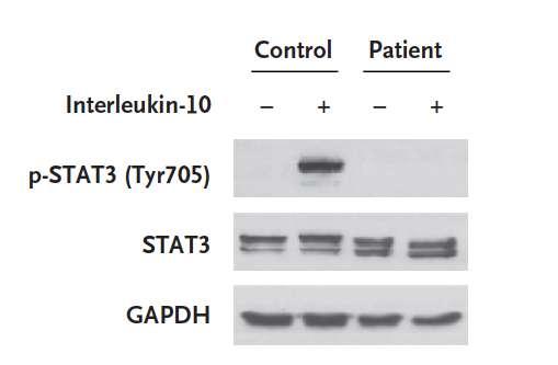 Defekt i IL-10 Receptor