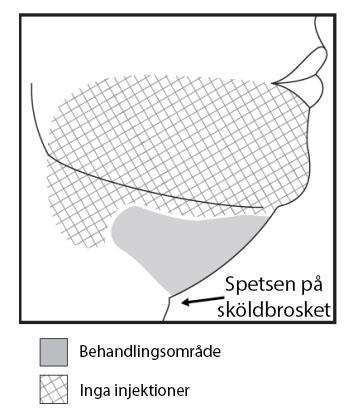 Bild 1. Undvik området kring ramus marginalis mandibularis Undvik injektion i platysma.