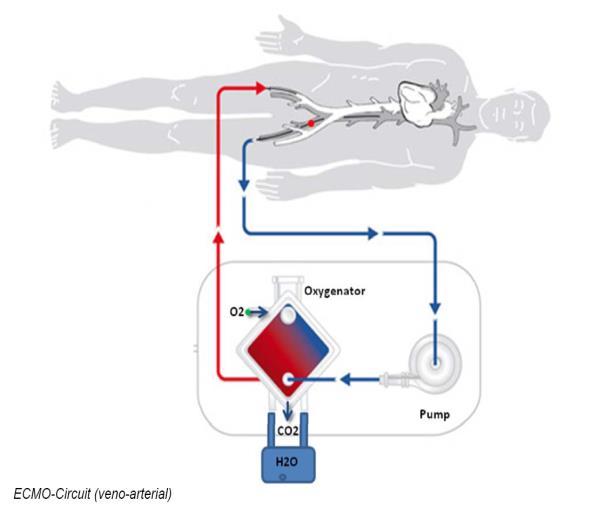 ECMO-KRETSEN ECMO kretsen består av: slangar centrifugalpump oxygenator svepgasflöde (gas/o2) regulator värmeväxlare Slangarna är heparincoatade för att minska inflammatorisk aktivitet och risk för