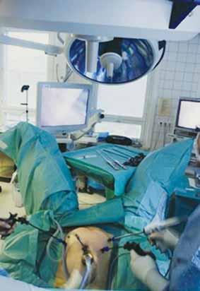 man är tvungen att konvertera en operation i dag är att en stor tumör är fixerad och därför svårmanövrerad.