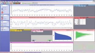 TLC-DIGIMATIC kabel 170 119 Benämning 06930013 TESA RUGOSURF 20 1920 1499 06930013P TESA ROUGHNESS ANALYSER SET 2195 1850 Består av: