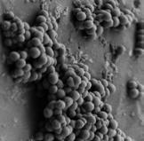 7 600 000 400 000 Reduktion av mikrobiell adhesion med BIP CVC 7 standardkatetrar BIP CVC 200 000 CFU/cm 2-91% 40 000-86% 20 000 0-76% -50% Pseudomonas aeruginosa Koagulasnegativa Staphylococcus
