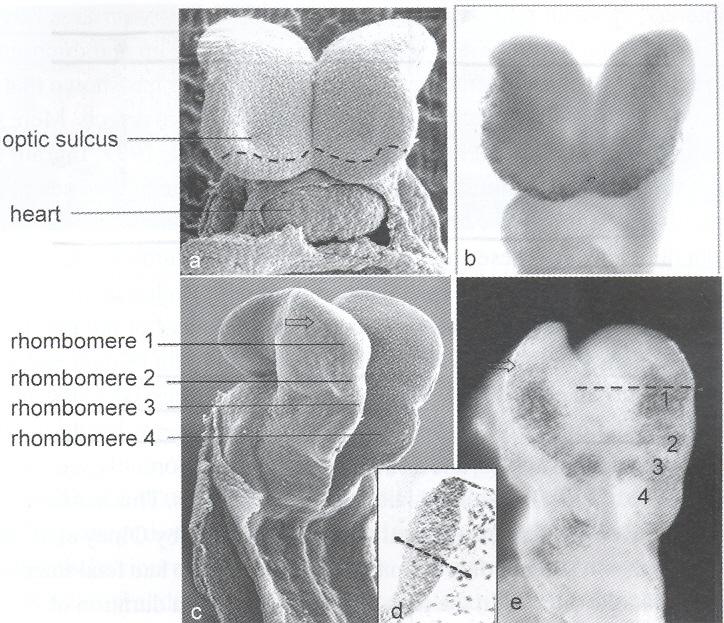 Apoptos vid neuralplattans periferi (mus embryo