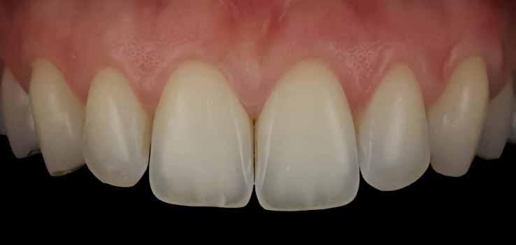 Enkel kommunikation MELLAN LAB - KLINIK 5500K (dagsljus)