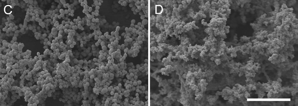 2017-04-25 Biofilm Biofilm Är IE en biofilmsinfektion?