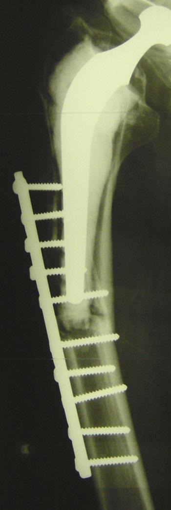 73-year male,