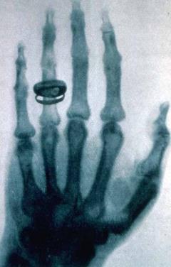 X-ray picture of the