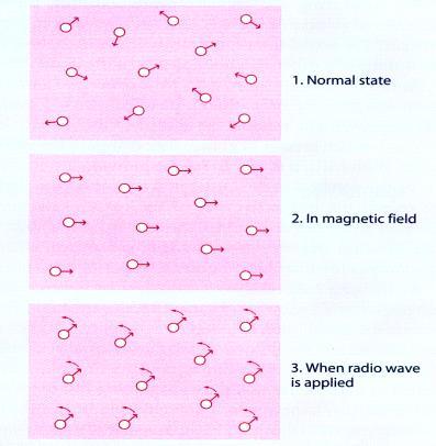 funktion (diffusion, perfusion, cortikala