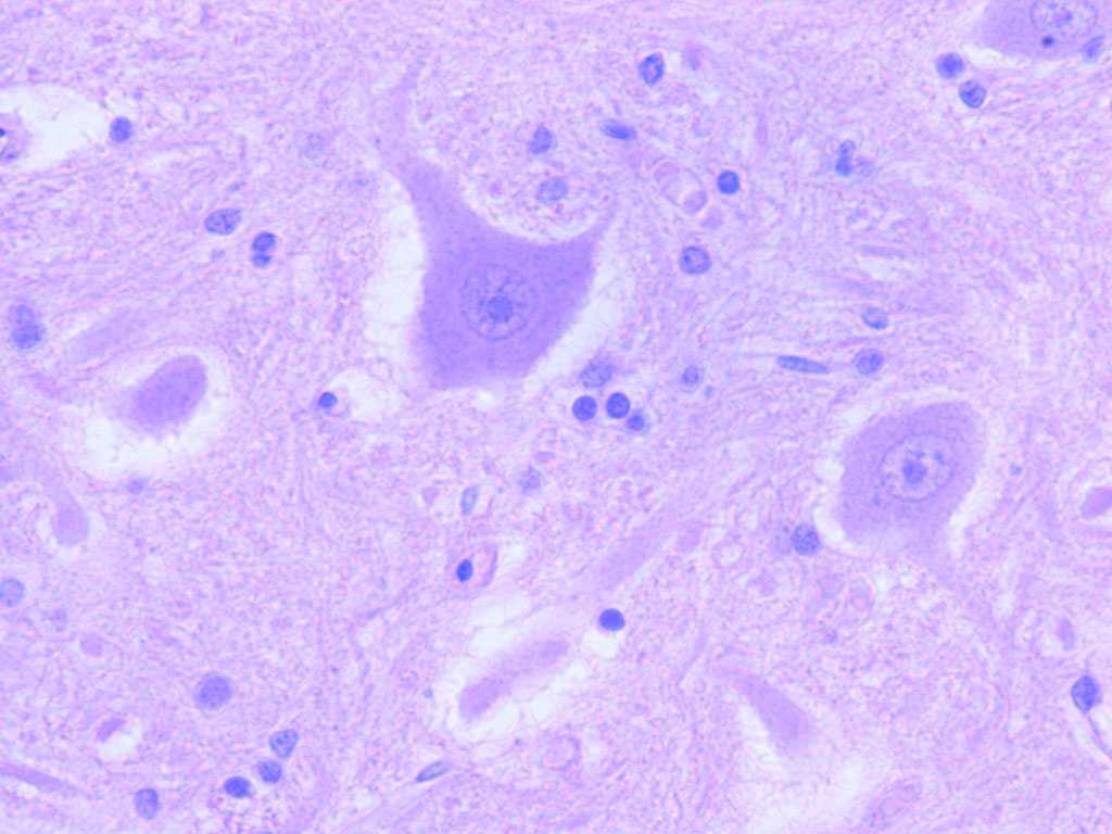 nervceller Elektrisk signal (nervimpuls) till kemisk signal (signalsubstans eller neurotransmittor)