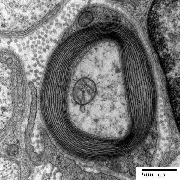 Gliaceller (stödjeceller) Stödjer, hjälper i ämnesomsättning, bildar myelin Myelin: Isolerande skikt omring axon, snabbare ledning I centrala nervsystemet finns bara myeliniserade axoner I periphera