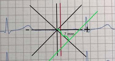 Figur 7. Bilden ovan visar samma koordinatsystem som i figur 5.