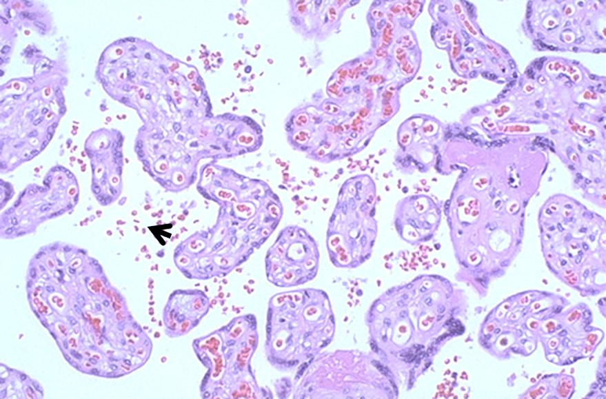 Fråga 118 Fett bryts ner i mag-tarm kanalen av enzymer som kallas lipaser. Vad stämmer bäst avseende lipaser i mag-tarm kanalen? a. Gastriskt lipas hämmas av lågt ph och kommer att bli aktiverat när det når duodenum b.