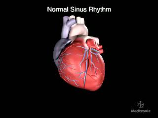 Strokeprevention vid