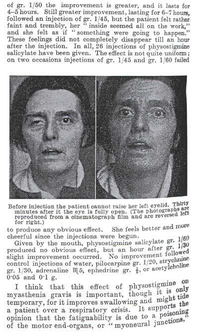 84 år