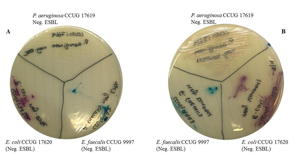 2B) av E. coli och E. faecalis men det förekom färgomslag på de kromogena medierna (Figur 2). P.