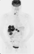 Glukosmetabolism Aminosyrametabolism Blodflöde Speciella enzymer Speciella receptorer