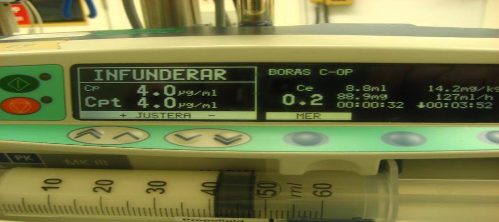 2016-11-28 26353 25 (41) Allteftersom Propofol påverkar patienten så börjar hon/han prata allt mer. Efter en stund blir talet allt mer sluddrigt för att avta helt. OBS!