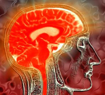 Kognitiva störningar och stress Ingen ålder eller könsskillnad Inte relaterade till graden av depression eller utmattning Den lägre prestationen verkar inte vara beroende av motivation, utan av