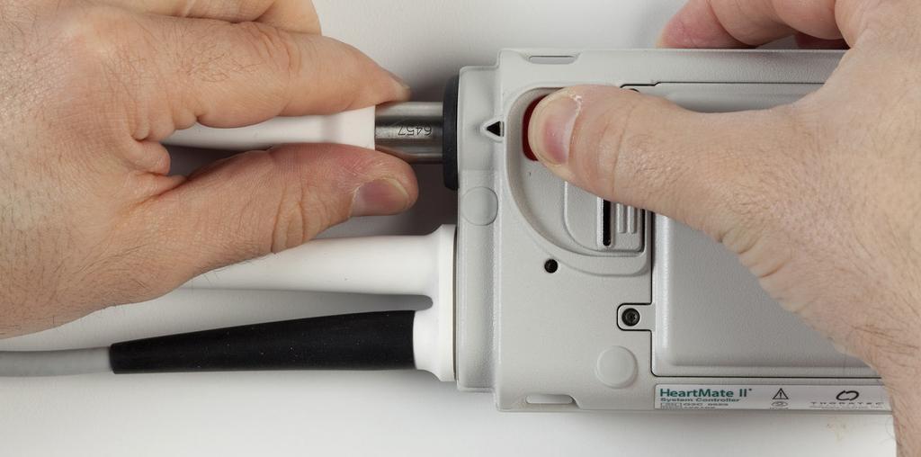 Ring din kontaktperson på sjukhuset om du har frågor. ÅTGÄRD 1. Samla ihop utrustningen; placera inom räckhåll. 2. Vrid säkerhetsvredet på den perkutana kabelkontakten till upplåst läge (Figur 11).