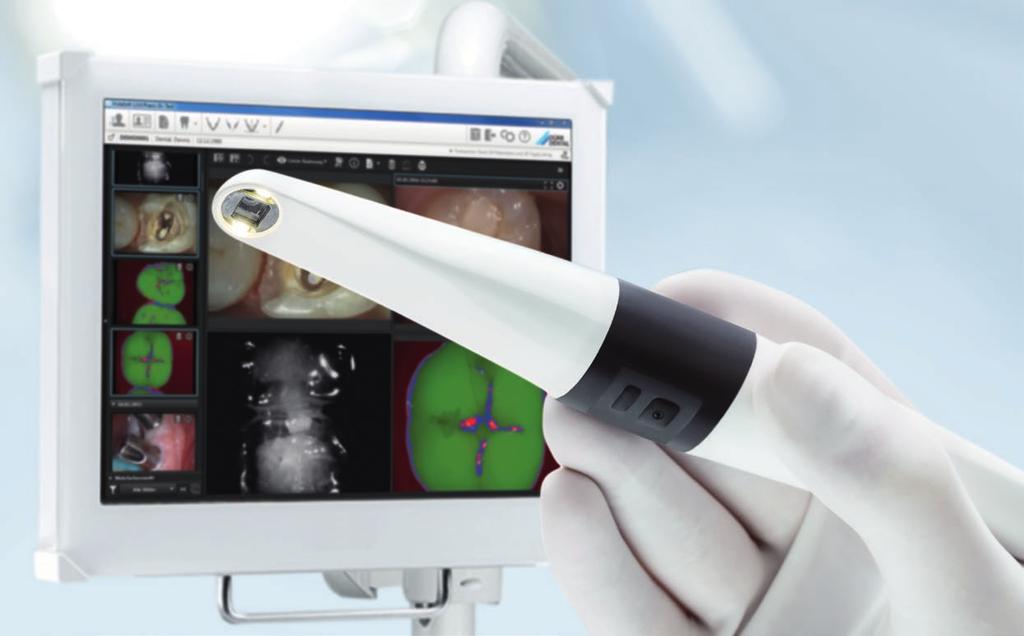 VistaCam ix HD för diagnostikstöd i