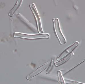 Figur 3. Förekomsten av artkomplexet Achnanthidium minutissimum (t.v.) och släktet Eunotia (E. meisteri, t.h.) ingår i beräkningen av surhetsindexet ACID, Medins Biologi AB. Tabell 3.