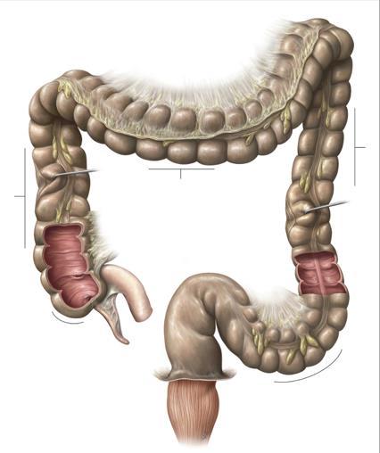 6 Skriv ej ovanför Linjen 23. Gallan produceras i levern, men lagras emellertid i ett säckliknande organ. Vad kallas detta organ? (1 p) Svar: Vesica biliaris/gallblåsa.