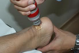 Biological action of shockwave (ESWT) therapy Vad är ESWT?