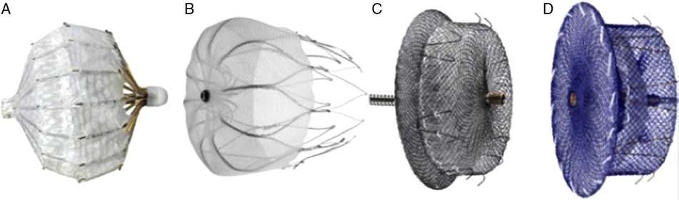 Det finns olika CE-märkta produkter PLATO (A), WATCHMAN device (B) och AMPLATZER cardiac plug (C). PLATO finns inte längre tillgänglig p.g.a. bristande säkerhet.