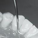 Använd korta rörelser på 2-3 mm för att hålla kontroll. För alla tandytor, speciellt approximalytor.