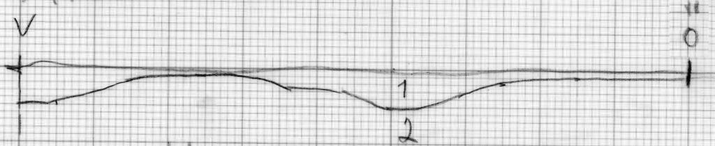 2 -