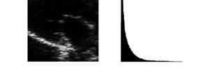 akustisk impedans som vi kan se något av strukturen. Vi behöver förstärka små värden i bilden relativt de större för att få en mer lätt-tolkad bild. Idealet är ett klockformat histogram.