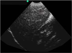 transducers Schematic image of an ultrasound